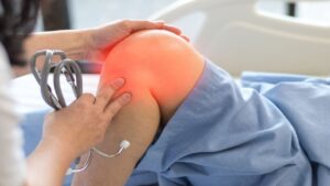 The Doctor Checks Up Patient Knee Bone and Joint for Patellofemoral Infection and Osteochondritis