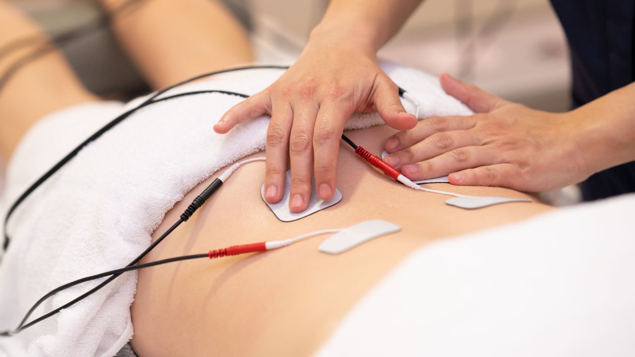 Electrical Muscle Stimulation (E-STIM) Therapy in Marco Island