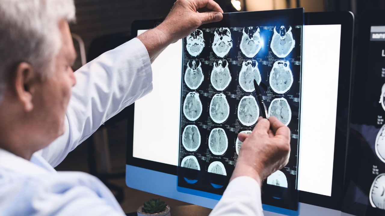 TBI / Concussion Therapy in Estero